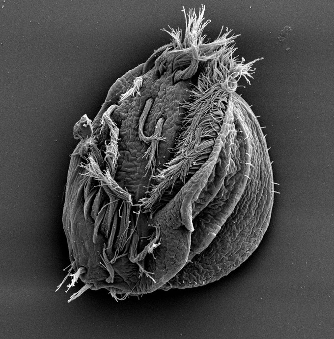 Ce microbe se transforme en « Hulk » cannibale Le dessous du protiste Euplotes gigatrox montre de nombreux cils ressemblant à des poils entourant une dépression ovale qui est la bouche de l'organisme.