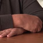 Coronavirus. Malgré un retour d'Italie et des symptômes, le SAMU refuse de venir