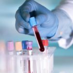 Les personnes de type sanguin A pourraient être plus vulnérables au coronavirus, selon une étude chinoise