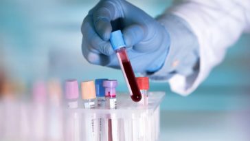 Les personnes de type sanguin A pourraient être plus vulnérables au coronavirus, selon une étude chinoise