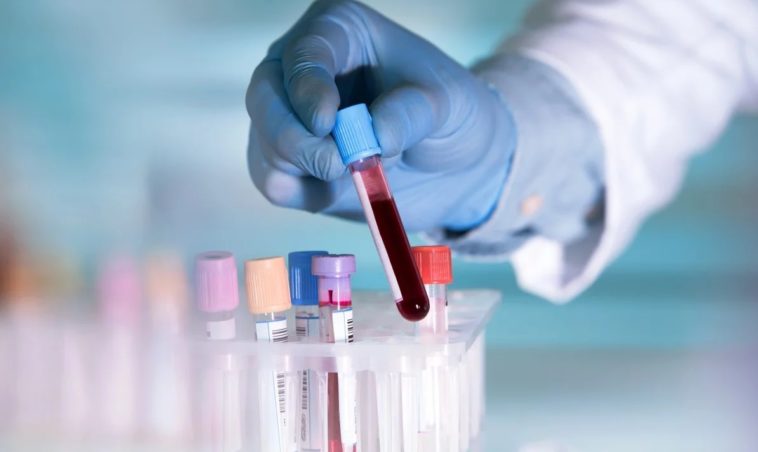 Les personnes de type sanguin A pourraient être plus vulnérables au coronavirus, selon une étude chinoise