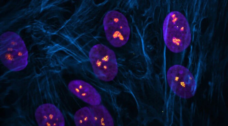 Dangers cachés : des scientifiques découvrent les effets inattendus des médicaments anticancéreux Fluorescent Image Showing Cells With Normal Nucleoli in Nuclei