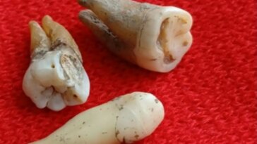 Ancient Teeth