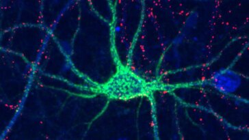 Sugars Affect Brain Plasticity
