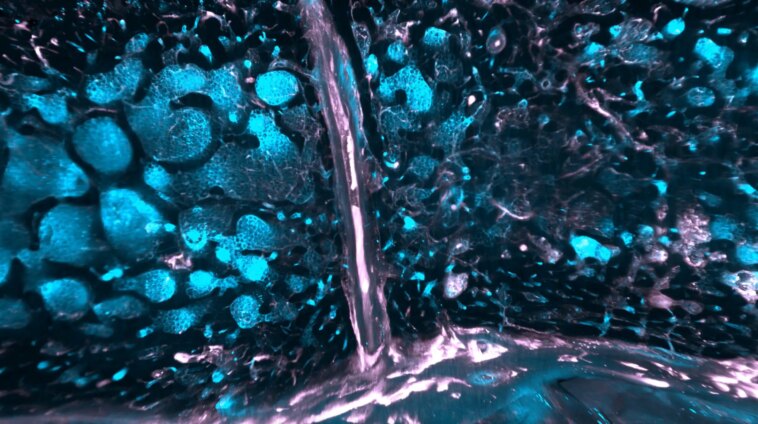 Gardien de l'esprit : le rôle surprenant du crâne dans la santé du cerveau