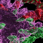 Inverser la maladie d'Alzheimer : la thérapie par cellules souches est prometteuse Systemic Transplantation of Wild Type Hematopoietic Stem and Progenitor Cells