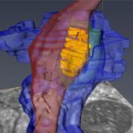 See Through Image of Synapse