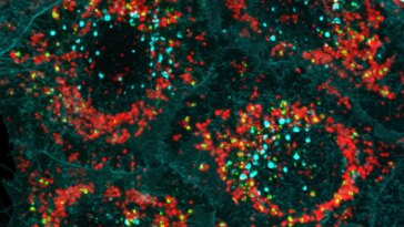 Un mystère de longue date résolu : de nouvelles découvertes réécrivent la compréhension du parcours de la maladie de Parkinson