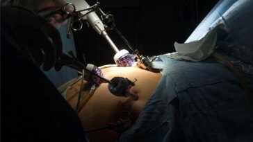 Gastric Bypass Surgery