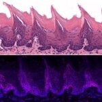 ORAI1 and Oral Cancer
