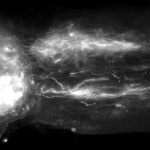 Défier « l’impossible » – Inverser la paralysie grâce à la régénération de la moelle épinière Défier « l’impossible » – Inverser la paralysie grâce à la régénération de la moelle épinière