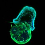 Des découvertes surprenantes : les premiers animaux étaient-ils nés comme des prédateurs ? Early Planula Larval Stage of the Sea Anemone Aiptasia