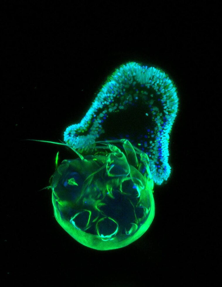 Des découvertes surprenantes : les premiers animaux étaient-ils nés comme des prédateurs ? Early Planula Larval Stage of the Sea Anemone Aiptasia