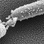 Le dilemme des superbactéries à l’hôpital : un traitement révolutionnaire émerge d’une recherche intensive