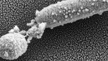 Le dilemme des superbactéries à l’hôpital : un traitement révolutionnaire émerge d’une recherche intensive