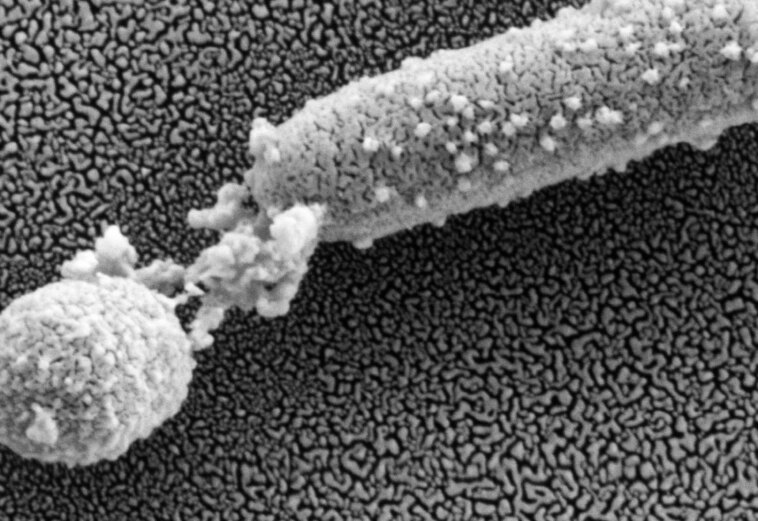 Le dilemme des superbactéries à l’hôpital : un traitement révolutionnaire émerge d’une recherche intensive