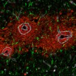 Astrocytes and Immune Cells