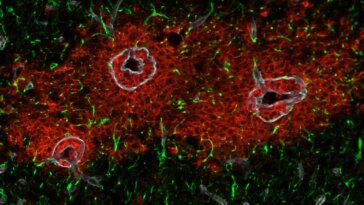 Astrocytes and Immune Cells