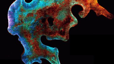 Brain Organoid Model Extended Neuroepithelium