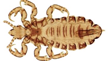 Head Louse