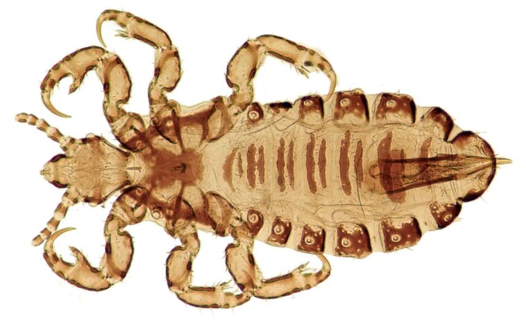 Lignées et sangsues : retracer la migration humaine et la colonisation dans les Amériques à travers les poux Head Louse