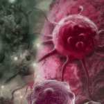 Moins d’effets secondaires – Une nouvelle méthode de traitement du cancer du pancréas Disintegrating Cancer Cell Illustration