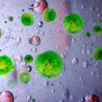 Meningitis Bacterial Infection