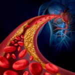 Une percée dans l’absorption du cholestérol à l’UCLA pourrait conduire à des traitements innovants