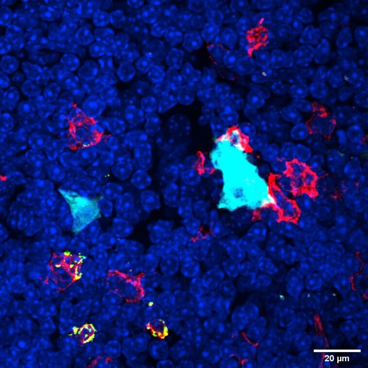 Des découvertes « fascinantes » – Des scientifiques ont découvert un nouveau type de cellule immunitaire SciTechDaily