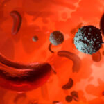 Sickle Cell Disease