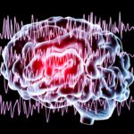 Brain Waves in Epilepsy