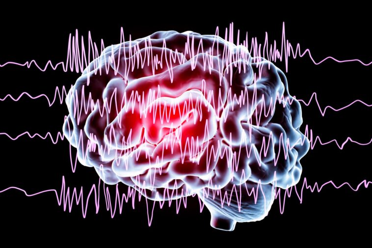 Brain Waves in Epilepsy
