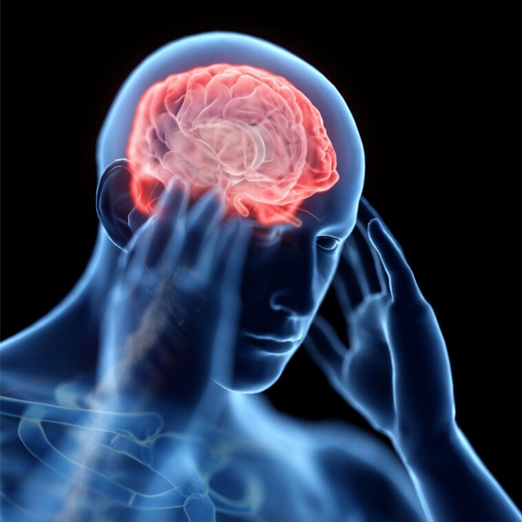 Bon marché ou cher : quel est le meilleur médicament contre les migraines ? SciTechDaily