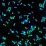 Nouvelles perspectives sur l’évolution, les biocarburants et le vieillissement cellulaire – Des biologistes ont développé une levure alimentée par la lumière SciTechDaily