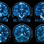 Percer les secrets de la perte de mémoire liée à l'âge SciTechDaily