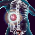 Des scientifiques ont découvert un gène « puissant », ouvrant la porte à de nouveaux traitements contre les maladies rénales SciTechDaily