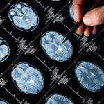 Indice neuronal de l'obésité : divergence dans le centre de l'appétit du cerveau SciTechDaily