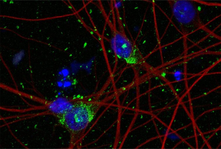 Révolutionner la recherche sur la maladie d'Alzheimer : des scientifiques de Cornell développent un modèle de neurone révolutionnaire SciTechDaily