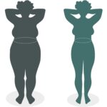 Perte de poids maintenue pendant 20 ans : une étude révèle l'efficacité à long terme du bypass gastrique SciTechDaily