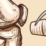 Un changement révolutionnaire pour les personnes souffrant d'arthrite : la solution synthétique de Texas A&M à la douleur au genou SciTechDaily