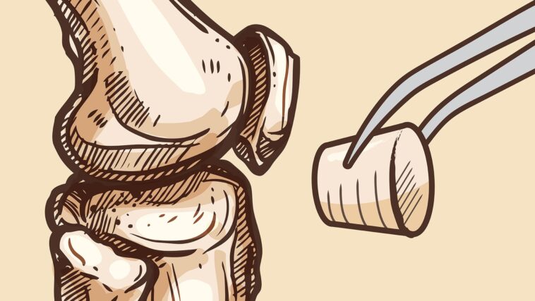 Un changement révolutionnaire pour les personnes souffrant d'arthrite : la solution synthétique de Texas A&M à la douleur au genou SciTechDaily