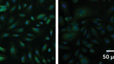 Cette image est composée de deux panneaux. À gauche, les cellules brillent en vert. À droite, l'image est beaucoup plus sombre et les cellules ne brillent pas autant.