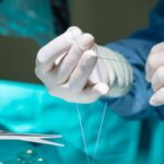 De nouveaux points électriques utilisent le mouvement musculaire pour accélérer la guérison