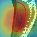 Les faisceaux radioactifs donnent une vision en temps réel du traitement du cancer chez la souris
