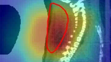 Les faisceaux radioactifs donnent une vision en temps réel du traitement du cancer chez la souris