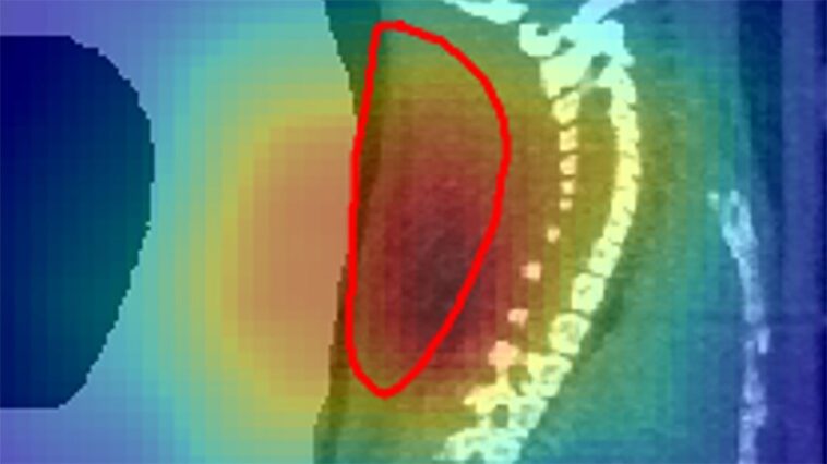 Les faisceaux radioactifs donnent une vision en temps réel du traitement du cancer chez la souris