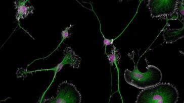 Des vrilles vertes relient des bouffées de vert et de magenta de différentes tailles sur un fond noir