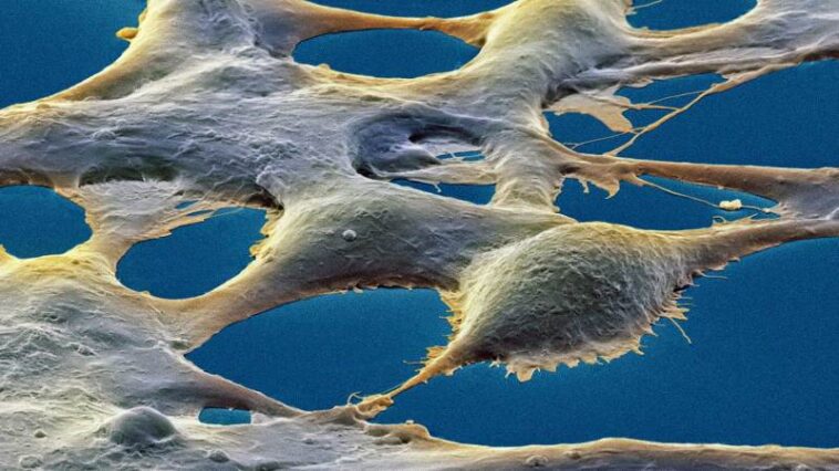 Comme les cellules du cerveau, les cellules rénales peuvent « se souvenir »