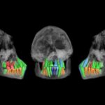 Des dents fossiles suggèrent un début étonnamment précoce de la longue enfance humaine Des dents fossiles suggèrent un début étonnamment précoce de la longue enfance humaine