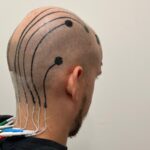 Les « tatouages ​​» électroniques offrent une alternative aux électrodes pour la surveillance du cerveau